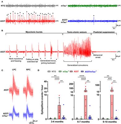 Ablating Tau Reduces Hyperexcitability and Moderates Electroencephalographic Slowing in Transgenic Mice Expressing A53T Human α-Synuclein